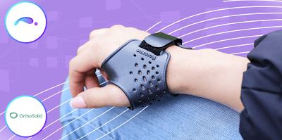 Getting to know… OrthoSolid: 3D Printed Orthoses and Prostheses!