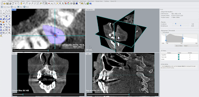 Segmeridian for Rhino – medical image segmentation